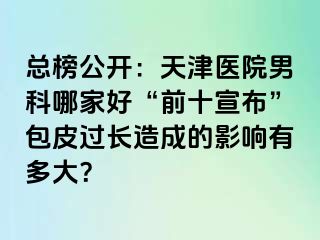 总榜公开：天津医院男科哪家好“前十宣布”包皮过长造成的影响有多大？