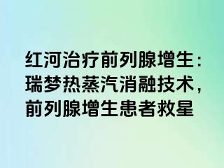 红河治疗前列腺增生：瑞梦热蒸汽消融技术，前列腺增生患者救星